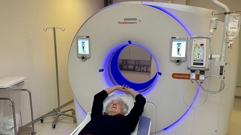 Bevolkingsonderzoek CT scan