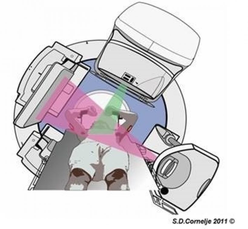 Radiotherapie