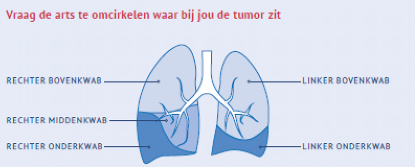 Omcirkel waar de tumor zit